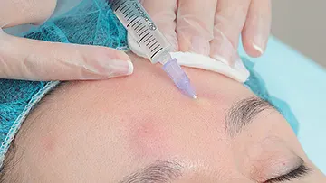  осложнения инъекционных методов в косметологии
