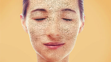 Сухость кожи – неизменный симптом кожных заболеваний